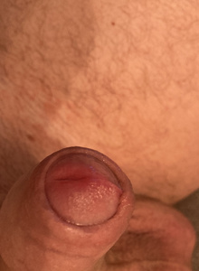 rendik27 cock1 photo 5395526