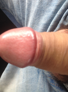 My Photos