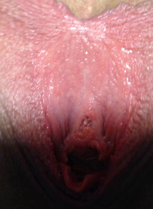 biglips
