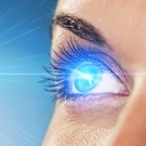  Laser vision correction