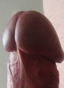 My Photos