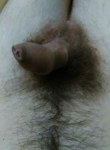 My Willy