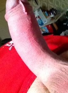 fire_dick photo 3363238 thumbnail