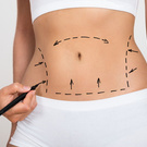 Liposuction
