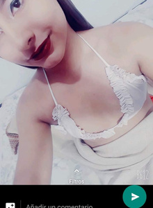 xiomyfox sexy photo 4883918