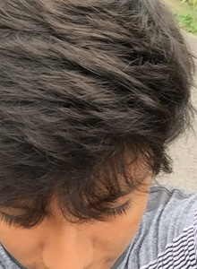 Ackem9 Live photo 4994116