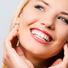 braces