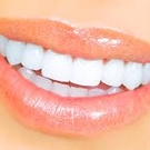 Hollywood Smile
