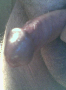 My Photos