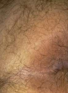 mole1128 photo 1591331 thumbnail