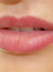 Fotografija #2318430