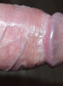 XREN-PEDALNYI Cтояк photo 4684231